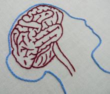 embroidered outline of female brain
